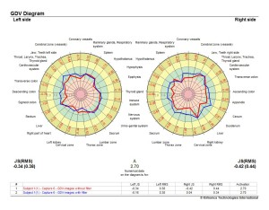 GDV Diagram Program maps psycho-emotional & physical state; conscious & subconscious issues